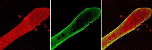 Neuromuscular research
