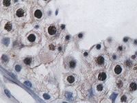 RNA binding protein research