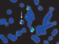 neuroblastoma research