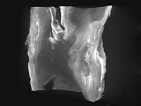 Cardiology research