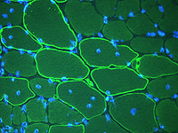 Neuromuscular research