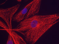 Neuromuscular research