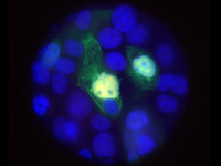 Wilms tumour research