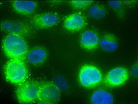 Endocrine research