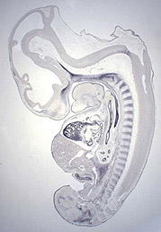 Developmental gene regulation