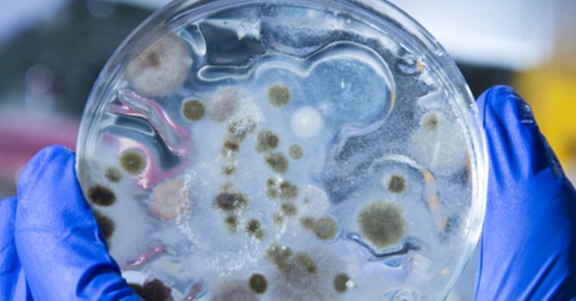 peteri dish with bacteria 