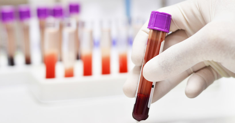 Blood in test tubes in a laboratory