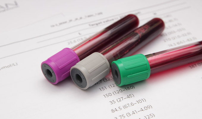 Blood in test tubes in a laboratory