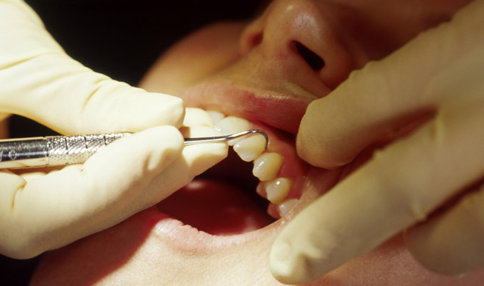 Dentist treating patient's teeth