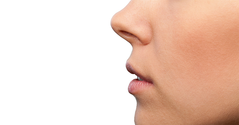 Surgery more effective than nasal sprays to treat crooked septum image