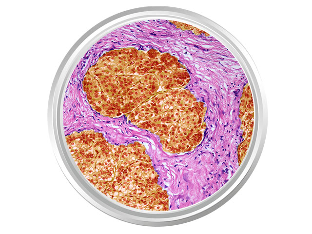 Cells in Petri dish.