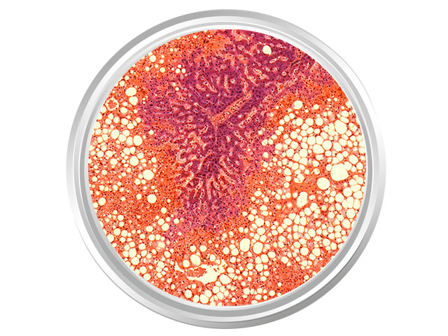 Cells in a Petri dish.