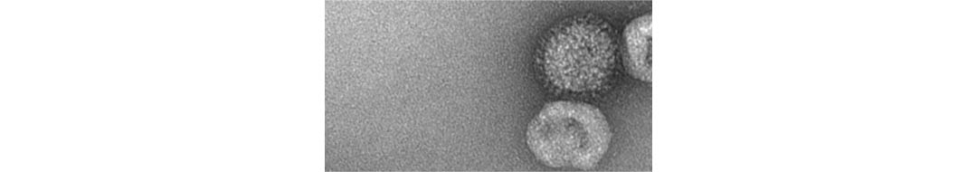 Scan of a virus