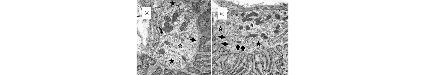 Neuromuscular junctions from two equine grass sickness horses