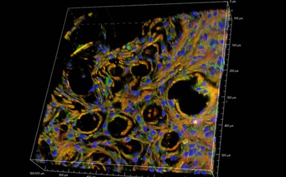 Bioprinted stem cells interacting with a 3D printed titanium alloy surface