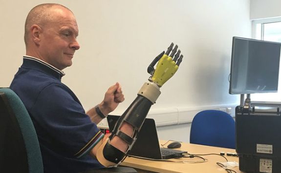 Prosthesis control - man using a prosthetic hand.