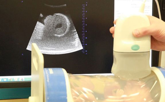 Low-cost Ultrasound imaging - laboratory testing