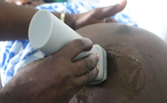 Low cost ultrasound imaging - clinical trials