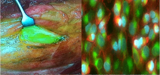 Cells